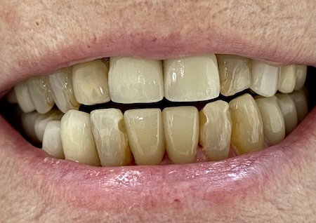 smile gallery image