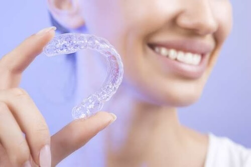 Invisalign experience