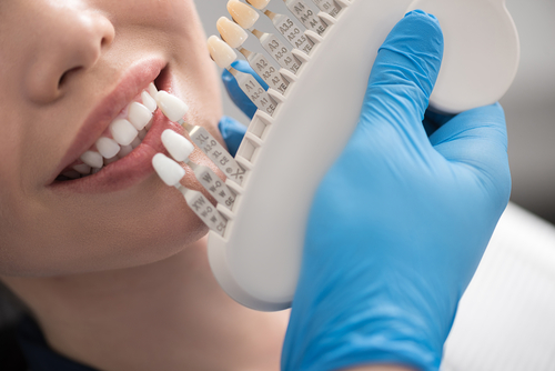 Woman in dental chair