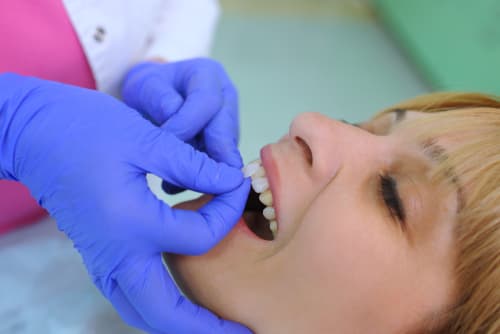 Woman receiving porcelain veneers 