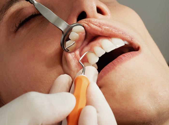 What Happens If Gum Disease Goes Untreated?