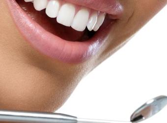 Cavity-Fighting Foods: What to Include in Your Diet