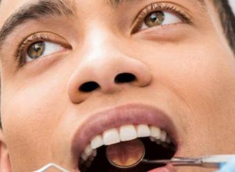 Congenital Aglossia: The Rare Condition of Absence of the Tongue